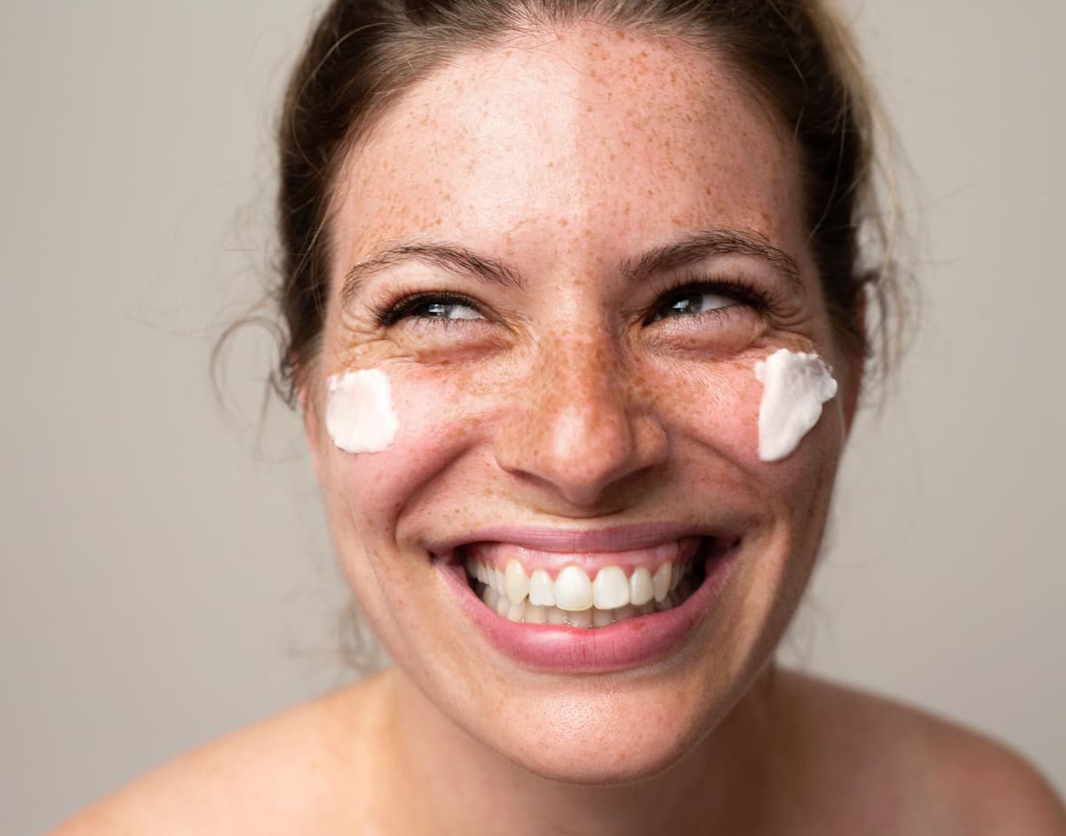 Hyperpigmentation